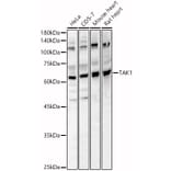 Western Blot - Anti-TAK1 Antibody (A90981) - Antibodies.com