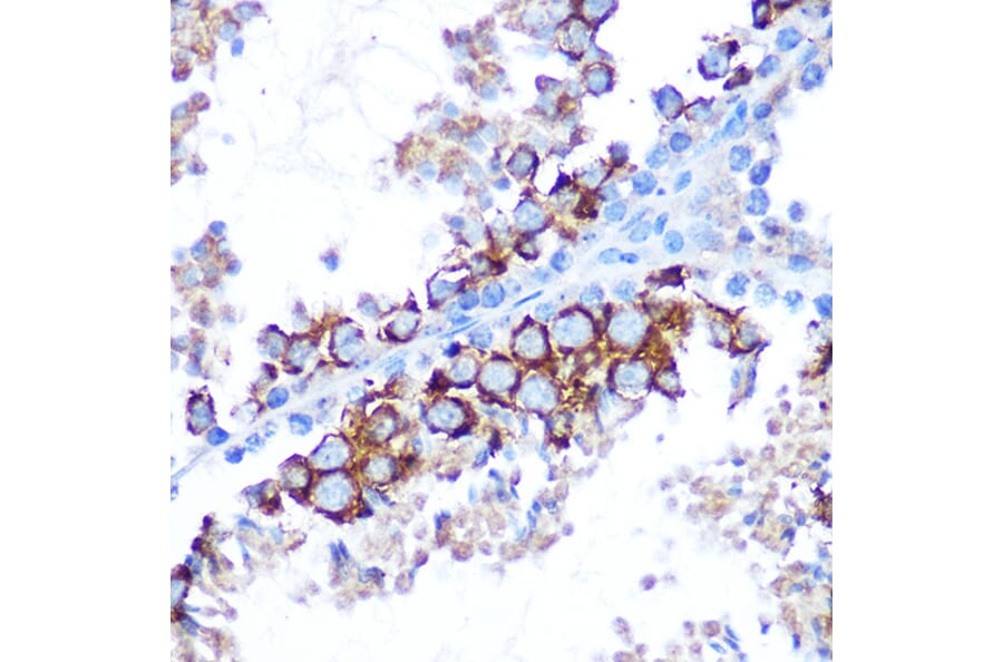 Immunohistochemistry - Anti-TAK1 Antibody (A90981) - Antibodies.com