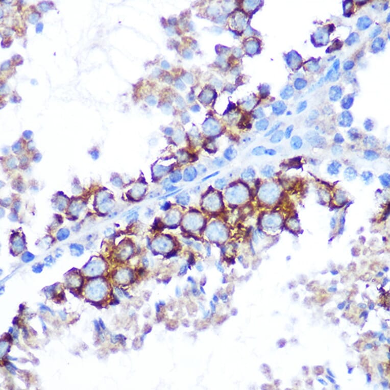 Immunohistochemistry - Anti-TAK1 Antibody (A90981) - Antibodies.com