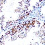Immunohistochemistry - Anti-TAK1 Antibody (A90981) - Antibodies.com