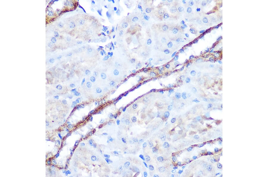 Immunohistochemistry - Anti-TAK1 Antibody (A90981) - Antibodies.com