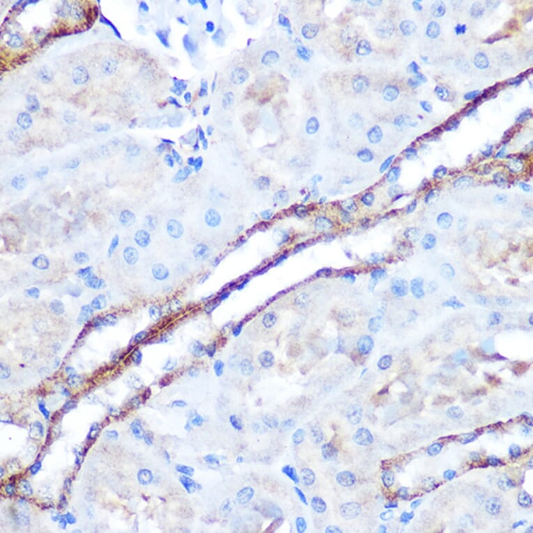 Immunohistochemistry - Anti-TAK1 Antibody (A90981) - Antibodies.com