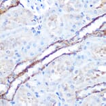 Immunohistochemistry - Anti-TAK1 Antibody (A90981) - Antibodies.com