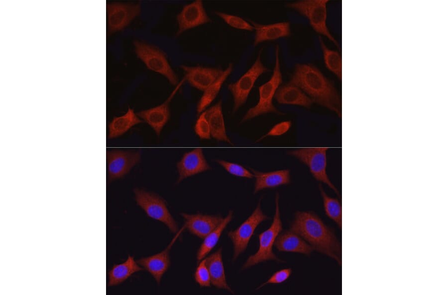 Immunofluorescence - Anti-TAK1 Antibody (A90981) - Antibodies.com