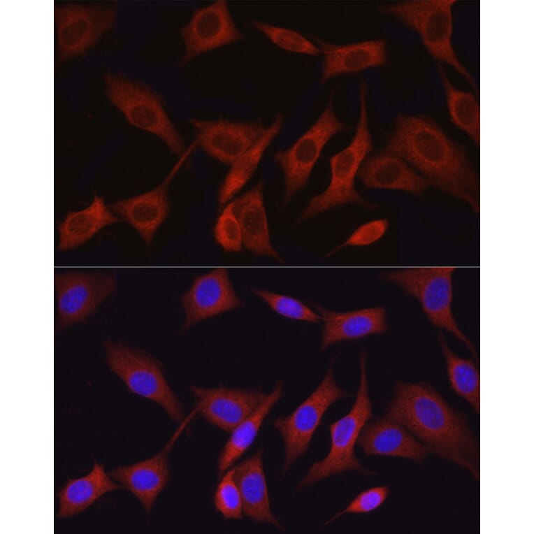 Immunofluorescence - Anti-TAK1 Antibody (A90981) - Antibodies.com