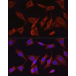 Immunofluorescence - Anti-TAK1 Antibody (A90981) - Antibodies.com