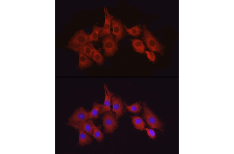 Immunofluorescence - Anti-TAK1 Antibody (A90981) - Antibodies.com