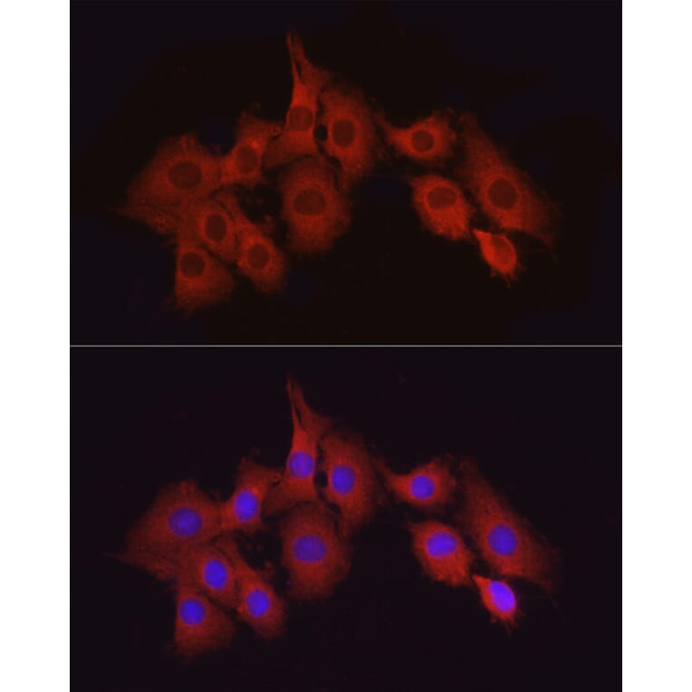 Immunofluorescence - Anti-TAK1 Antibody (A90981) - Antibodies.com