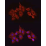 Immunofluorescence - Anti-TAK1 Antibody (A90981) - Antibodies.com