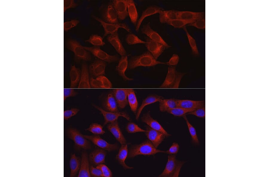 Immunofluorescence - Anti-TAK1 Antibody (A90981) - Antibodies.com