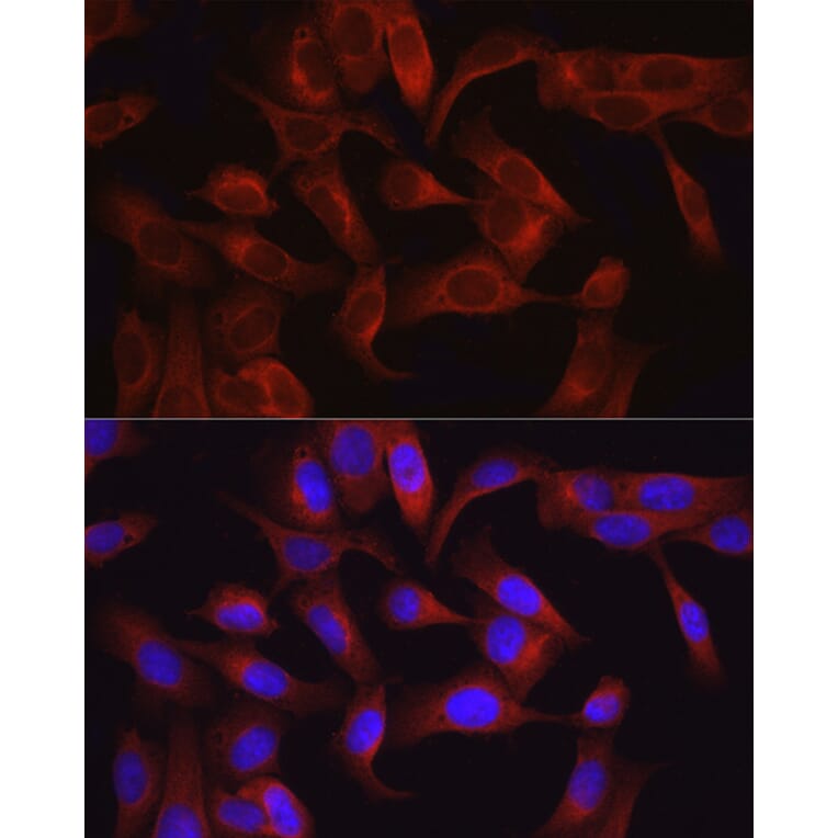 Immunofluorescence - Anti-TAK1 Antibody (A90981) - Antibodies.com