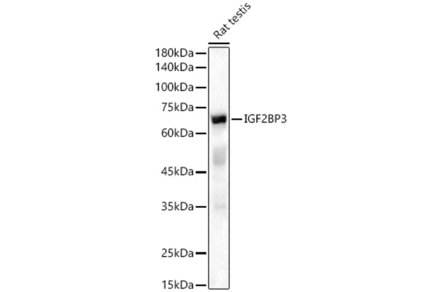 Western Blot - Anti-IMP3 Antibody (A90982) - Antibodies.com