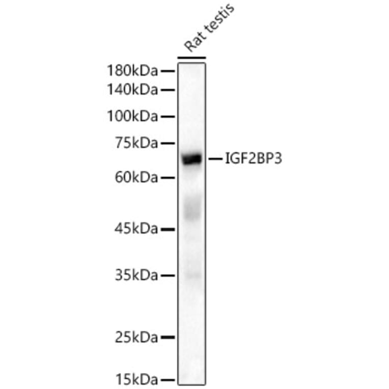 Western Blot - Anti-IMP3 Antibody (A90982) - Antibodies.com