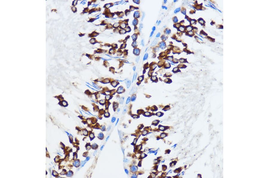 Immunohistochemistry - Anti-IMP3 Antibody (A90982) - Antibodies.com