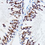 Immunohistochemistry - Anti-IMP3 Antibody (A90982) - Antibodies.com