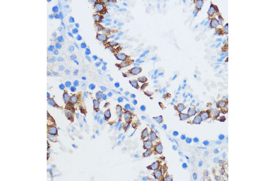 Immunohistochemistry - Anti-IMP3 Antibody (A90982) - Antibodies.com