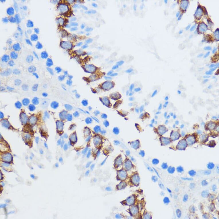 Immunohistochemistry - Anti-IMP3 Antibody (A90982) - Antibodies.com