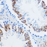 Immunohistochemistry - Anti-IMP3 Antibody (A90982) - Antibodies.com
