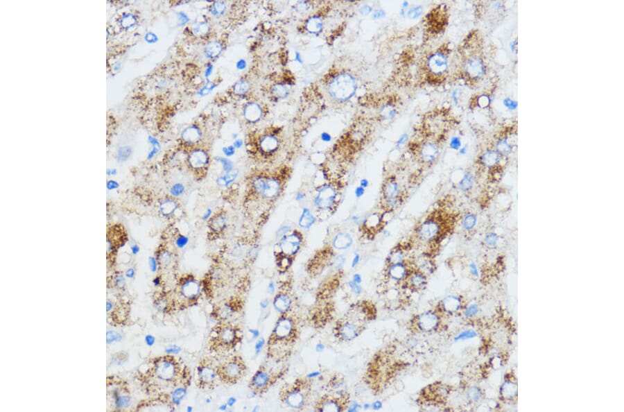Immunohistochemistry - Anti-IMP3 Antibody (A90982) - Antibodies.com