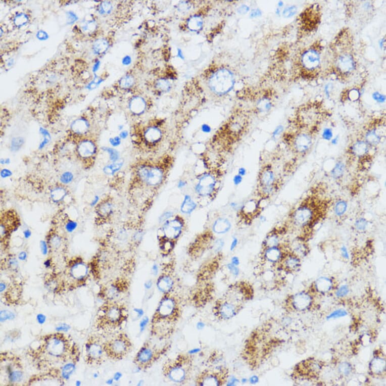 Immunohistochemistry - Anti-IMP3 Antibody (A90982) - Antibodies.com