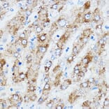 Immunohistochemistry - Anti-IMP3 Antibody (A90982) - Antibodies.com