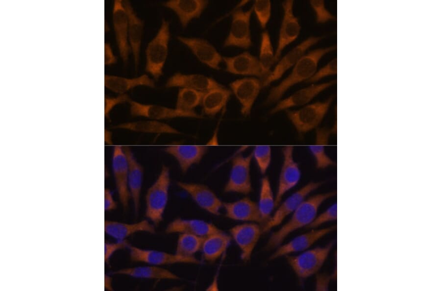 Immunofluorescence - Anti-IMP3 Antibody (A90982) - Antibodies.com