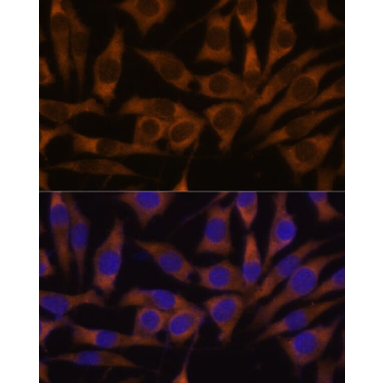 Immunofluorescence - Anti-IMP3 Antibody (A90982) - Antibodies.com