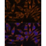 Immunofluorescence - Anti-IMP3 Antibody (A90982) - Antibodies.com