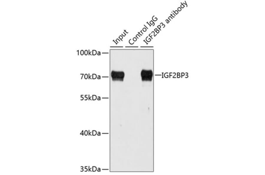 Western Blot - Anti-IMP3 Antibody (A90982) - Antibodies.com
