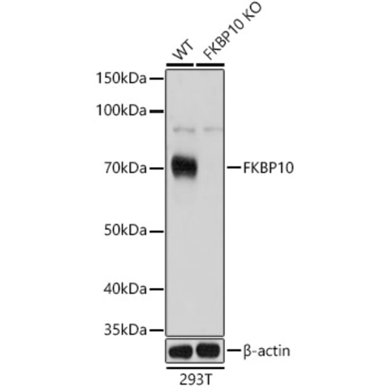 Western Blot - Anti-FKBP10 Antibody (A90983) - Antibodies.com