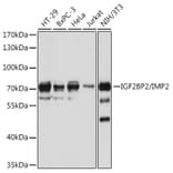 Western Blot - Anti-IGF2BP2/IMP-2 Antibody (A90984) - Antibodies.com