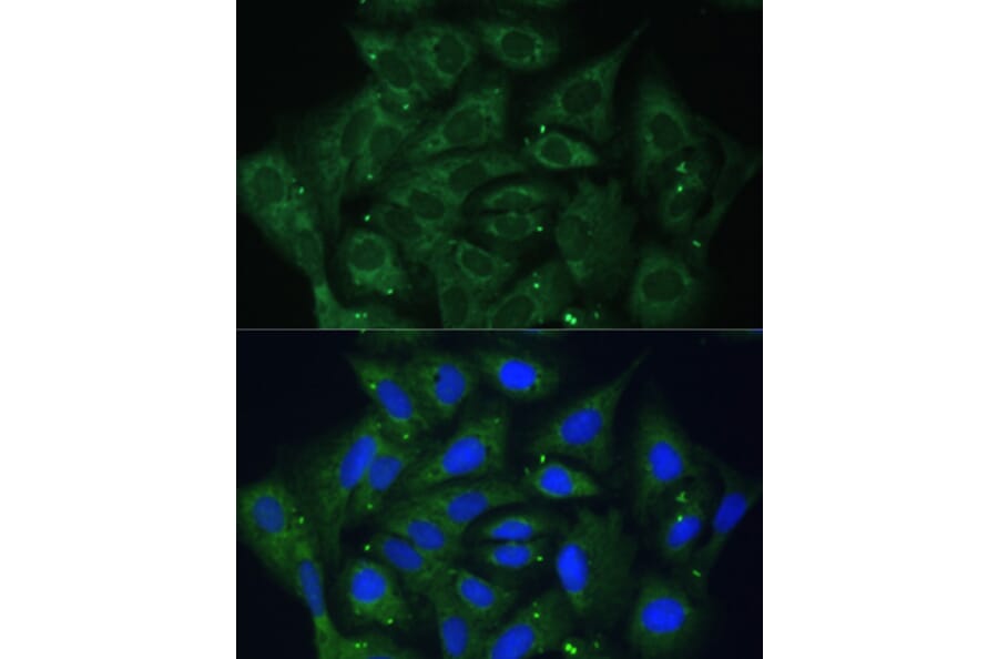 Immunofluorescence - Anti-IGF2BP2/IMP-2 Antibody (A90984) - Antibodies.com