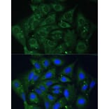 Immunofluorescence - Anti-IGF2BP2/IMP-2 Antibody (A90984) - Antibodies.com