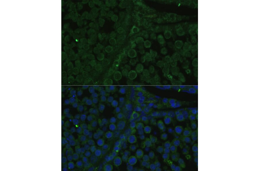 Immunofluorescence - Anti-IGF2BP2/IMP-2 Antibody (A90984) - Antibodies.com