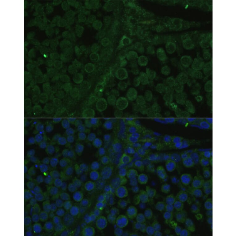 Immunofluorescence - Anti-IGF2BP2/IMP-2 Antibody (A90984) - Antibodies.com