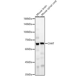 Western Blot - Anti-Choline Acetyltransferase Antibody (A90985) - Antibodies.com