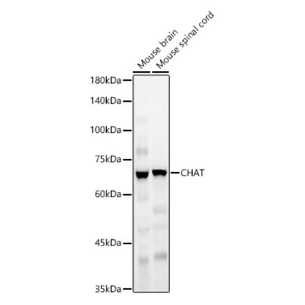 Western Blot - Anti-Choline Acetyltransferase Antibody (A90985) - Antibodies.com