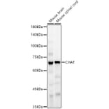 Western Blot - Anti-Choline Acetyltransferase Antibody (A90985) - Antibodies.com