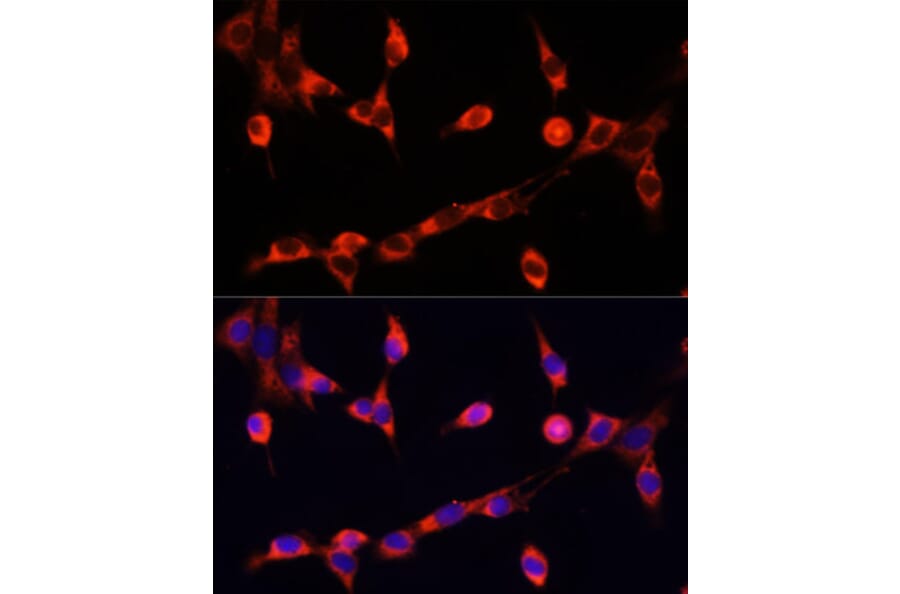 Anti-Choline Acetyltransferase Antibody (A90985) | Antibodies.com