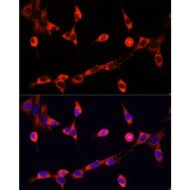 Immunofluorescence - Anti-Choline Acetyltransferase Antibody (A90985) - Antibodies.com
