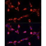 Immunofluorescence - Anti-Choline Acetyltransferase Antibody (A90985) - Antibodies.com