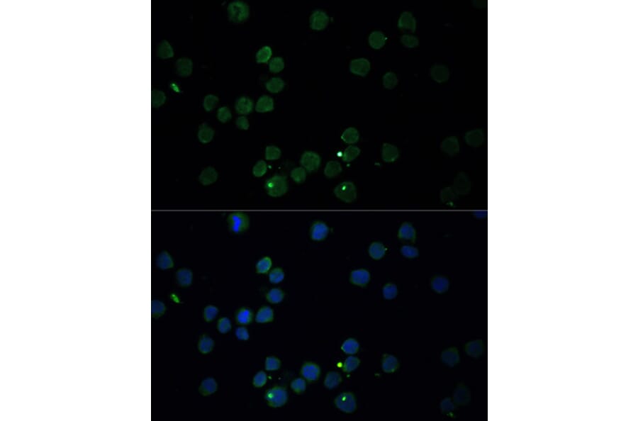 Immunofluorescence - Anti-Choline Acetyltransferase Antibody (A90985) - Antibodies.com