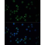 Immunofluorescence - Anti-Choline Acetyltransferase Antibody (A90985) - Antibodies.com