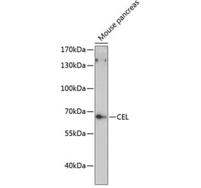 Western Blot - Anti-CEL Antibody (A90986) - Antibodies.com