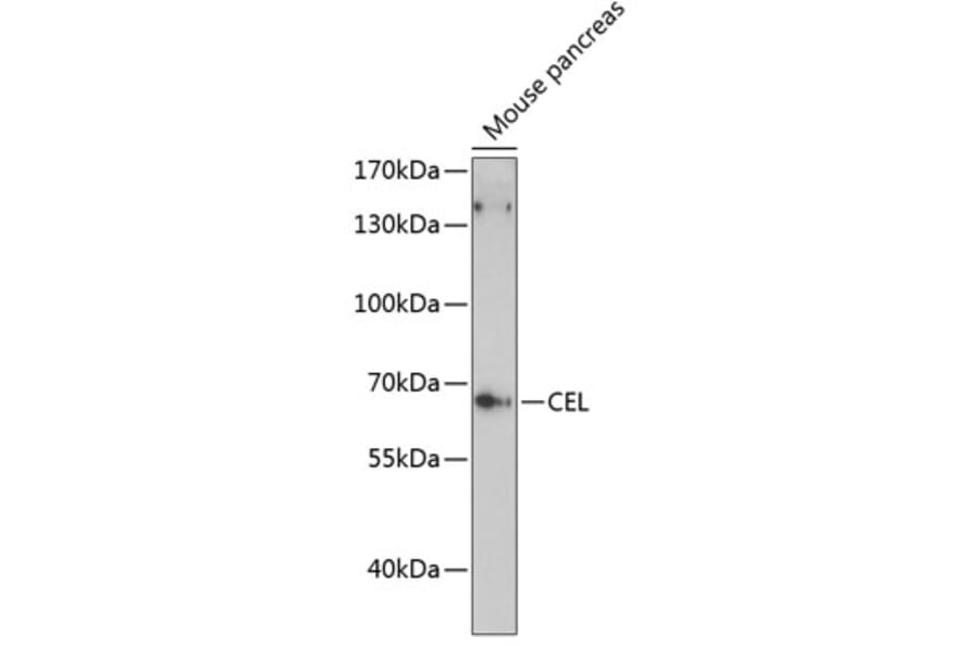 Western Blot - Anti-CEL Antibody (A90986) - Antibodies.com