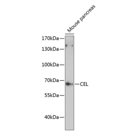 Western Blot - Anti-CEL Antibody (A90986) - Antibodies.com