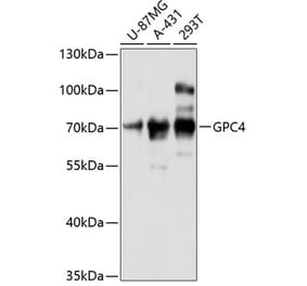 Western Blot - Anti-Glypican 4 Antibody (A90987) - Antibodies.com