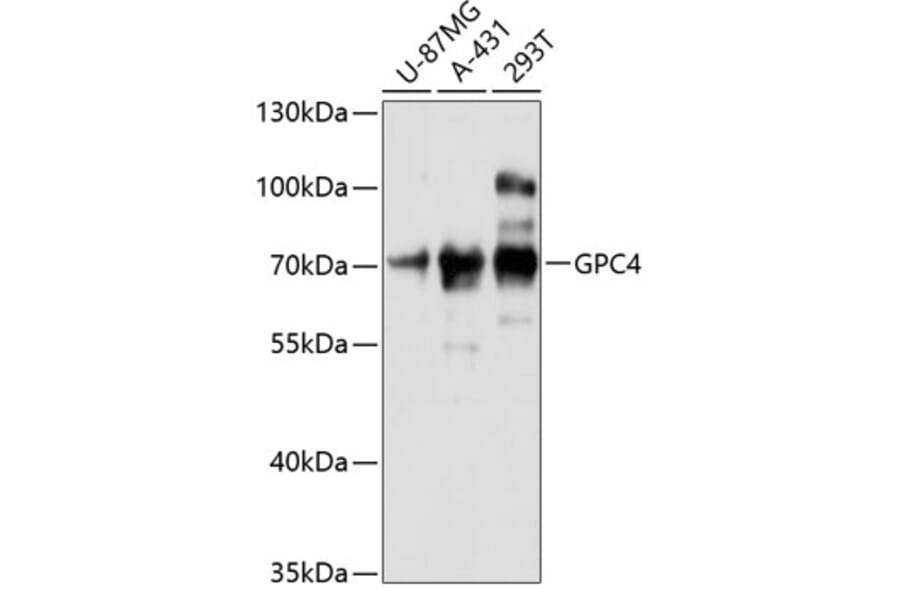 Western Blot - Anti-Glypican 4 Antibody (A90987) - Antibodies.com