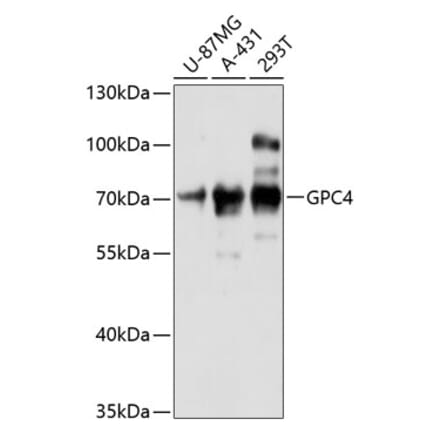 Western Blot - Anti-Glypican 4 Antibody (A90987) - Antibodies.com