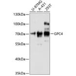 Western Blot - Anti-Glypican 4 Antibody (A90987) - Antibodies.com